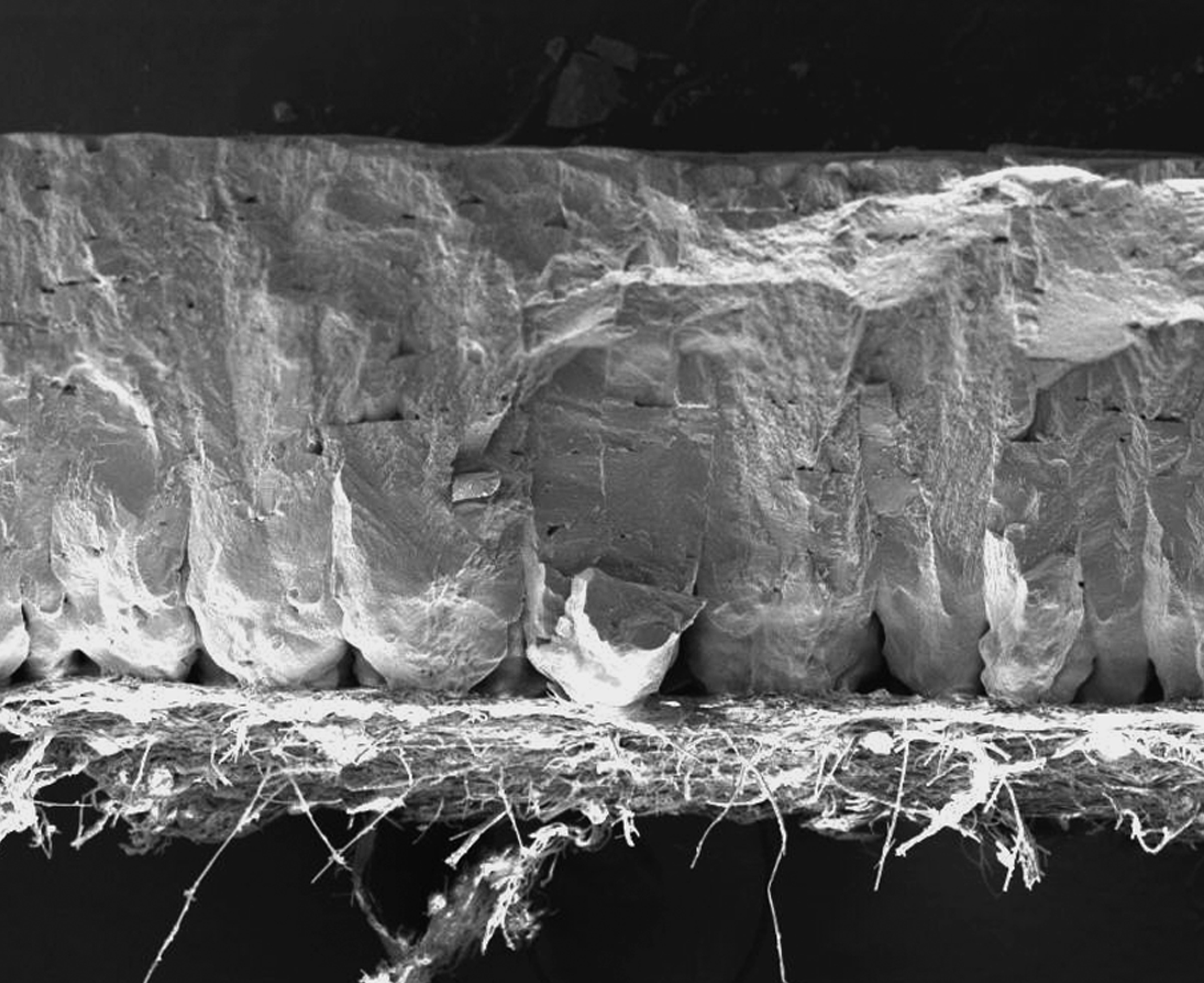 Electron micrograph showing microstructure of an eggshell (domestic chicken).
