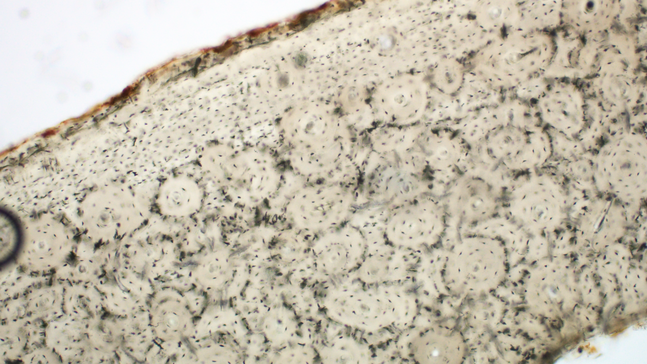 Compact bone under a microscope. This image is from a rib in a fossil deer.