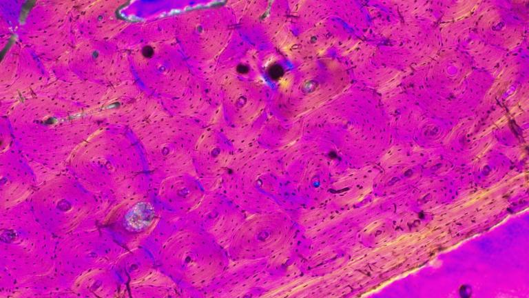 Compact bone under a microscope. This image is from a rib in a fossil deer.