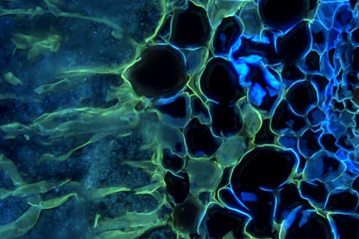 Cyanobacteriën (blauwe stippen) binnenin de koraalachtige wortel van de cycade